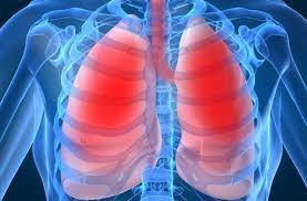Пневмонія легень - симптоми і лікування