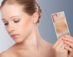 Підшкірний кліщ на обличчі - симптоми і лікування