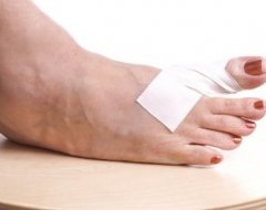 Вальгусна деформація пальця стопи – лікування та операція