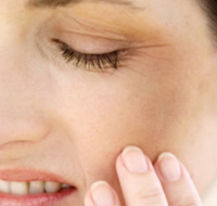 Ефективні способи лікування гематоми на обличчі