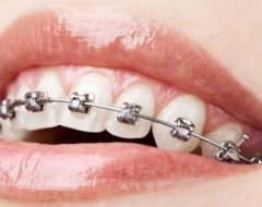Ортодонтія важлива галузь стоматології