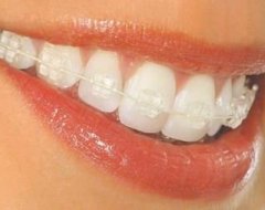 Коли людині потрібна допомога стоматолога ортодонта