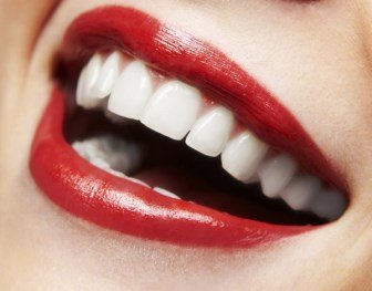Відбілювання зубів: різні варіанти