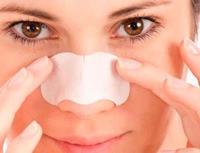 Прищі на носі: причини і лікування в домашніх умовах