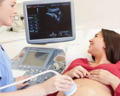 УЗД під час вагітності: відповіді на найпопулярніші питання