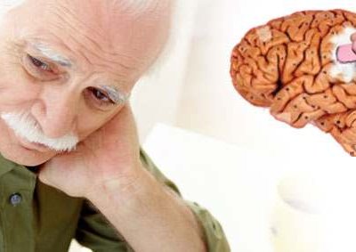Хвороба Альцгеймера: причини, симптоми і ознаки