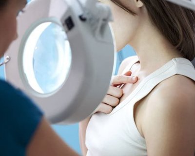 10 питань дерматологу: про видалення родимок, небезпеки веснянок і несподіваних причини сухості шкіри
