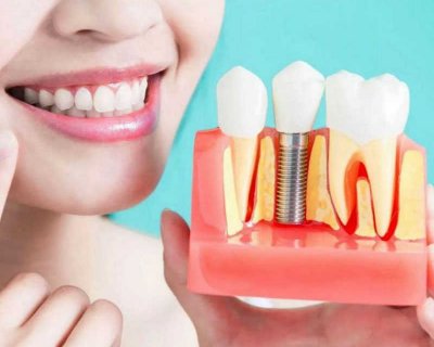 5 причин, за якими потрібно обов'язково відновлювати відсутні зуби