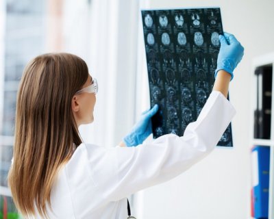 Перші ознаки та симптоми інсульту у чоловіків та жінок (розповідає експерт)