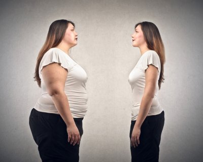 Скальпель замість дієти. Чи можна схуднути за допомогою операції?
